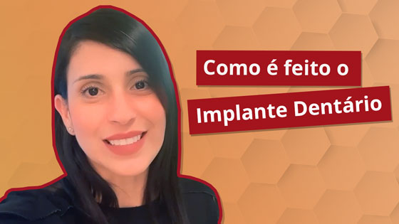 Como é feito o implante dentário